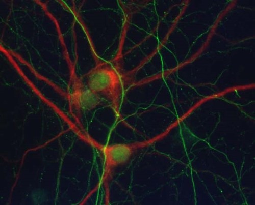 Cultivo primario neuronal con detección del marcador de dendritas MAP2 (rojo) y del marcador de axones Neurofilament (verde)./UB.