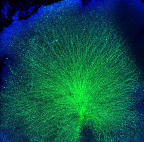 Axones de neuronas. Imagen: CSIC.