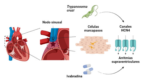 La infección por T. cruzi aumenta la expresión de los canales HCN4 de las CM. En estas condiciones el tratamiento con Ivabradina puede dar lugar a la aparición de arritmias supraventriculares/UAM