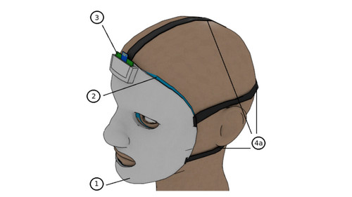 La máscara semirrígida de presoterapia con sensores de presión.