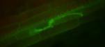 Células de maíz invadidas por el hongo causante de la antracnosis, Colletotrichum graminicola. Las células de la planta tienen formas rectangulares y el hongo aparece en verde fluorescente. Foto: Michael Thon.