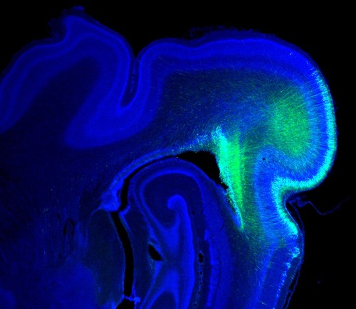 Imagen del cerebro de un hurón. / IN (CSIC-UMH).