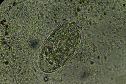 El parásito ‘Schistosoma mansoni’, causante de la esquistosomiasis intestinal en seres humanos. FOTO: IVIC