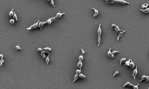 Imagen de microscopia electrónica de células de ‘Mycoplasma genitalium’. / IBB-UAB.