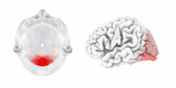 Imágenes de las zonas del cerebro que se activan en el experimento sobre hiperactividad.