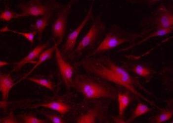 Ejemplo de tinción con fluoropaque (FOTO: GIR Neurobiología).