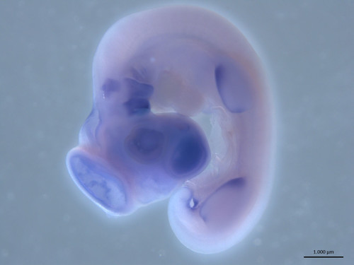 El método de RNA interferencia es una técnica novedosa evaluada en embriones de pollo que analiza las funciones genéticas asociadas con malformaciones de la mandíbula. Fotos: Joan Sebastián Joya, estudiante de la maestría en Ciencias.