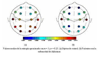 A la derecha el análisis mediante entropía aproximada de un cerebro con Alzheimer con una actividad regular, a la izquierda uno sano con más actividad