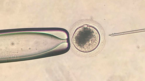 Fertilización in vitro mediante la técnica ICSI. Foto: gentileza investigador.