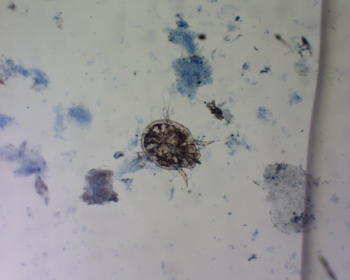 Imagen al microscopio del agente productor de sarna psoróptica