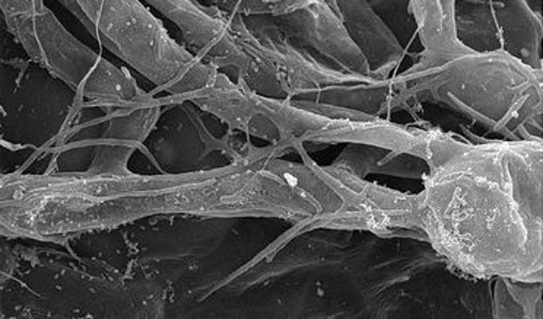 Foto microscópica del hongo de plantas Pseudozyma aphidis que en raras ocasiones produce infecciones en personas. FOTO: AGENCIA CYTA