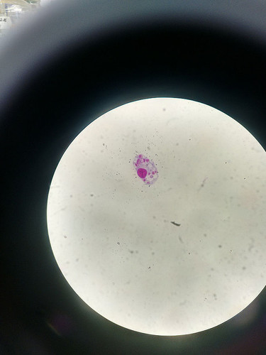 Célula infectada con parásitos de Leishmania (los puntos más pequeños)/UN
