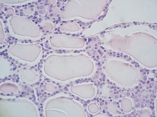 Vista amplia de un corte de tiroides teñido con Tinción hematoxilina-eosina/Andrea Mazza