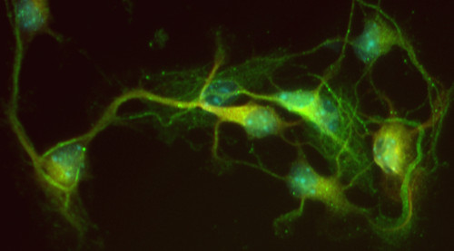 Neuronas. Foto: CSIC.