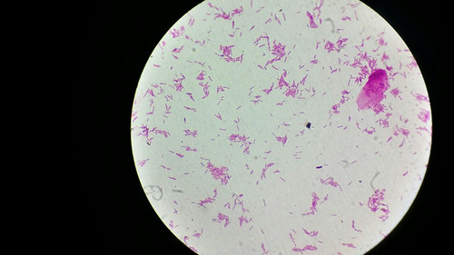Estas bacterias pueden crecer en minerales como cuarzo, feldespato y calcita. Foto: Julián Corzo.