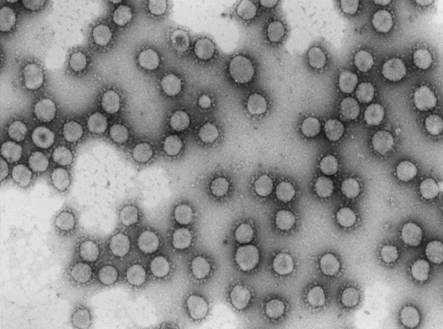 Virus de la familia coronaviridae. / Foto: Luis Enjuanes CNB-CSIC.