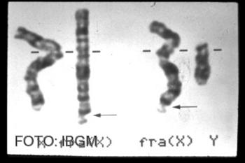 Imagen que muestra la fragilidad del extremo del cromosoma.