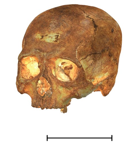 Uno de los cráneos deformados artificialmente que ha sido reconstruido/IPHES