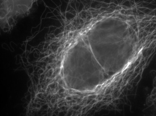 Los microtúbulos son el esqueleto de nuestras células, les dan forma y regulan la división. / CSIC.