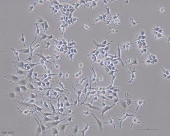 Imagen al microscopio de un cultivo de células tumorales hepáticas tratado con melatonina (1.000 micromolar/litro), donde se aprecia la reducción de células tumorales.
