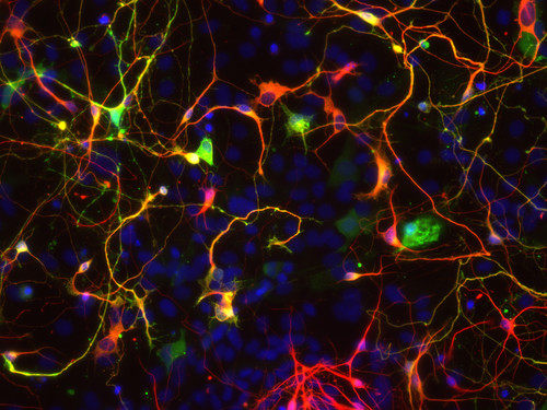 Astrocitos talámicos reprogramados en neuronas in vitro tras la infección con un virus que induce la sobreexpresión del gen Neurogenin2. / Álvaro Herrero Navarro.
