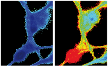 Imagen digital del calcio en una célula por microscopía de fluorescencia (FOTO: IBGM).