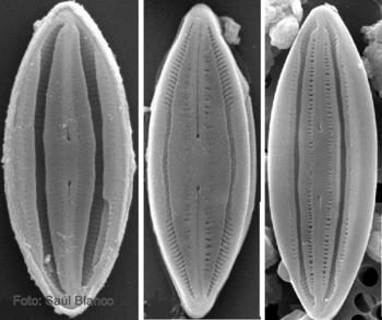 Diatomeas de las especies 'Microcostatus angloensis', 'Microcostatus cholnokyi' y 'Microcostatus schoemanii' (de i. a d.). Foto: Saúl Blanco