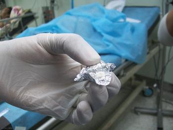 Papel aluminio conteniendo cocaína obtenido de un paciente en un hospital.
