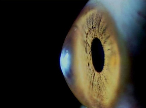 La córnea, la lente más externa del ojo, se debilita con el paso del tiempo./ VioBio Lab-CSIC.