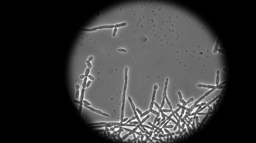 Acinetobacter baumannii. Foto: CONICET Fotografía.