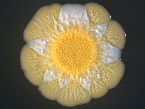 Colonia de S. aureus crecida durante 5 días diversificando subpoblaciones (con pigmentación diferente). Imagen: CSIC.