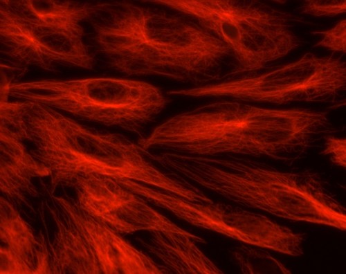 Imagen de la proteína de cápside en células vivas/gentileza FIL.