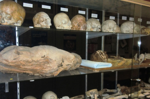 Algunas de las muestras de cráneos estudiadas, pertenecientes al departamento de Medicina Legal, Toxicología y Antropología Física de la Universidad de Granada. Foto: UGR.