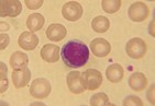 Imagen de un linfocito rodeado de glÃ³bulos rojos: Wikipedia