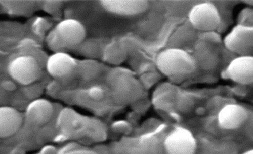 Nanoesferas de fertilizante. FOTO: CONACYT