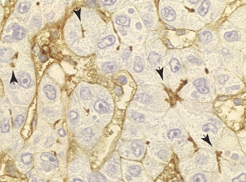 Células epiteliales de hígado. Imagen: CSIC.