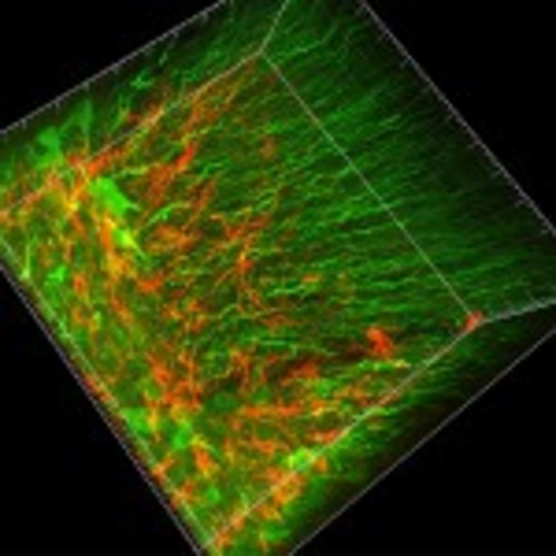 Imágenes 3D de gran resolución de regiones de la médula espinal de ratones obtenidas con la técnica desarrollada en el Instituto de Química y Fisicoquímica Biológicas. FOTO: AGENCIA CYTA