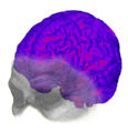 La evolución del cerebro del Homo sapiens puede ser el origen del alzheimer (FOTO: E. Bruner).