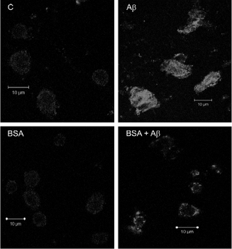 Beta-amiloide en el interior de la célula (arriba derecha), que se queda en el exterior con albúmina (abajo derecha). La parte izquierda es un grupo de control. Imagen de 'Journal of Alzheimer's Disease'.