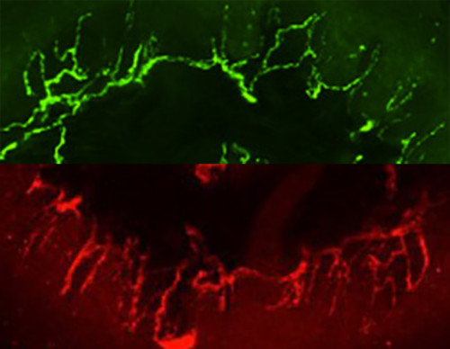 Los científicos identificaron el papel de las proteínas Lrig1 y Lrig3 en el crecimiento de los axones de las neuronas sensoriales (teñidas de verde y rojo en las imagenes) que inervan la piel..