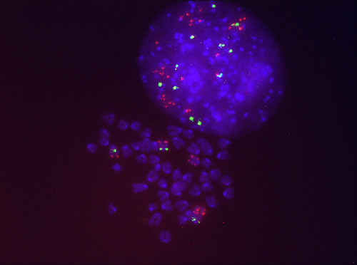 Células del cáncer de pulmón resistentes al Sotorasib que presentan varias copias del gen KRAS mutado (en rojo). / CIC.