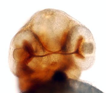 Embrión de pez cebra normal, que sirve de control. Imagen: Ángel Porteros.