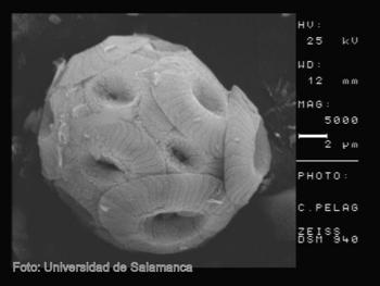 Cocosfera, la parte exterior de un cocolitóforo vista con 5.000 aumentos en un microscopio.