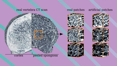 A partir de escaneos de vértebras es posible sintetizar automáticamente nuevas muestras artificiales.