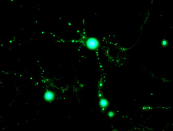 Neuronas apoptóticas. Foto: Ángeles Almeida.