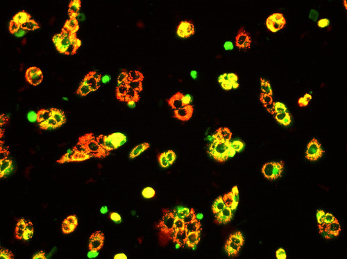 Señalización del daño mitocondrial provocado por la terapia combinada en células tumorales hepáticas./IIBB.