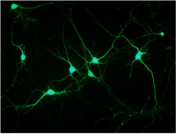 Neuronas sanas. Foto: Ángeles Almeida.