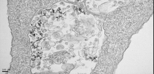 Imagen de microscopía de transmisión electrónica de células infectadas con SARS-CoV-2 y tratadas con nanopartículas de óxido de hierro. / Yadileiny Portillla y Servicio de Microscopía Electrónica, CNB-CSIC